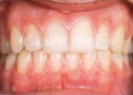 Picture2